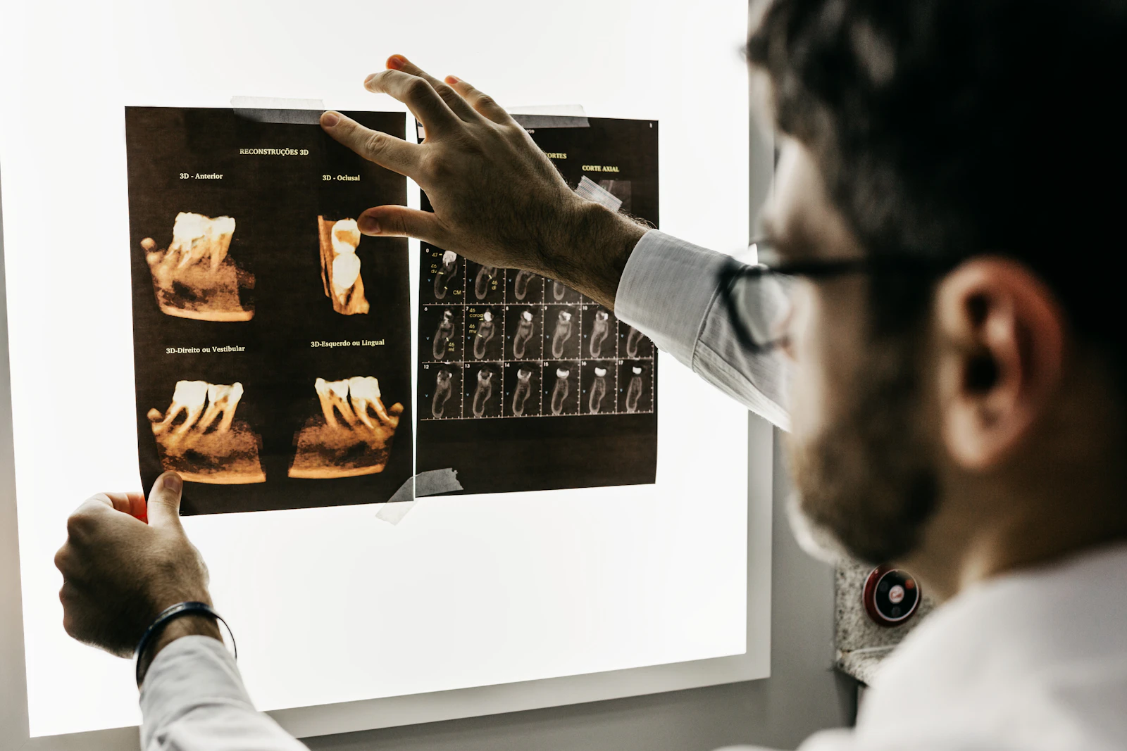 Odontólogo revisando imágenes dentales, representando la explicación clara de tratamientos antes de una consulta
